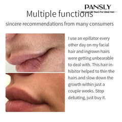 كريم منع نمو الشعر الدائم للحية والبكيني والساقين والجسم والإبط يوقف نمو الشعر ويقلص المسام وينعم البشرة