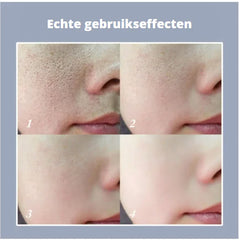 مزيل المسام السحري من ماركا شوب™ - ستيك برايم (اشتر واحدًا واحصل على الآخر مجانًا)