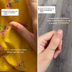 خاتم خرز لتهدئة الأعصاب